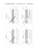 Intravascular Medical Device diagram and image