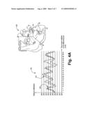 METHODS AND SYSTEMS FOR USE IN SELECTING CARDIAC PACING SITES diagram and image