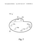 Automatic Capture Verification using Electrocardiograms Sensed from Multiple Implanted Electrodes diagram and image