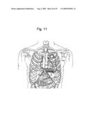 Automatic Capture Verification using Electrocardiograms Sensed from Multiple Implanted Electrodes diagram and image