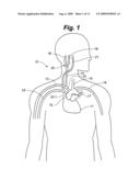 METHOD FOR MONITORING PHYSIOLOGICAL CYCLES OF A PATIENT TO OPTIMIZE PATIENT THERAPY diagram and image