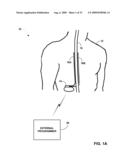 AUTOMATED PROGRAMMING OF ELECTRICAL STIMULATION ELECTRODES USING POST-IMPLANT IMAGING diagram and image