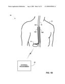 AUTOMATED PROGRAMMING OF ELECTRICAL STIMULATION ELECTRODES USING POST-IMPLANT IMAGING diagram and image