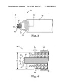 LEAD WITH MRI COMPATIBLE DESIGN FEATURES diagram and image