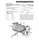 Vascular Stents, Methods of Use and Methods of Manufacture diagram and image