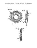 Vascular Stents, Methods of Use and Methods of Manufacture diagram and image