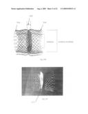 Vascular Stents, Methods of Use and Methods of Manufacture diagram and image