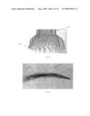 Vascular Stents, Methods of Use and Methods of Manufacture diagram and image