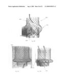 Vascular Stents, Methods of Use and Methods of Manufacture diagram and image