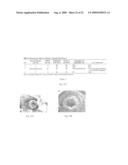 Vascular Stents, Methods of Use and Methods of Manufacture diagram and image