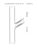 Assembly for the Treatment of Bifurcations diagram and image