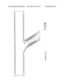 Assembly for the Treatment of Bifurcations diagram and image