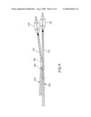 Assembly for the Treatment of Bifurcations diagram and image