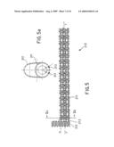 Assembly for the Treatment of Bifurcations diagram and image