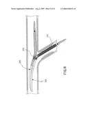 Assembly for the Treatment of Bifurcations diagram and image