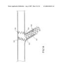 Assembly for the Treatment of Bifurcations diagram and image