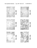 IMPLANT WITH A BASE BODY OF A BIOCORRODIBLE IRON ALLOY diagram and image