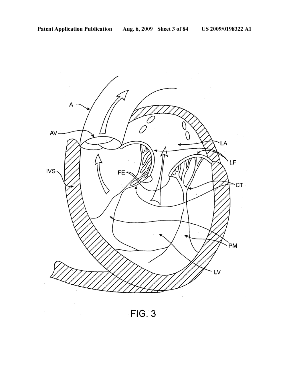 Methods And Apparatus For Cardiac Valve Repair - diagram, schematic, and image 04