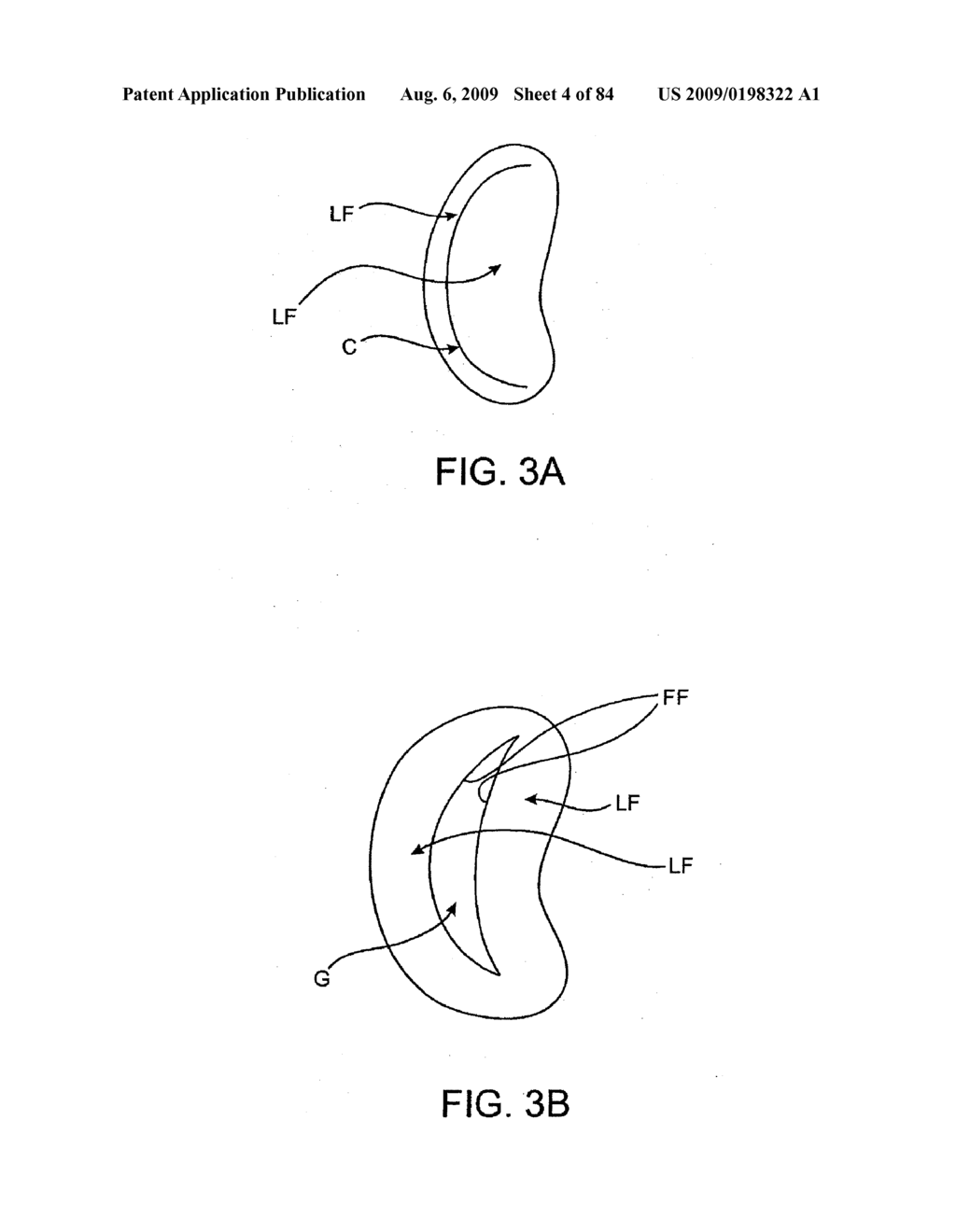 Methods And Apparatus For Cardiac Valve Repair - diagram, schematic, and image 05