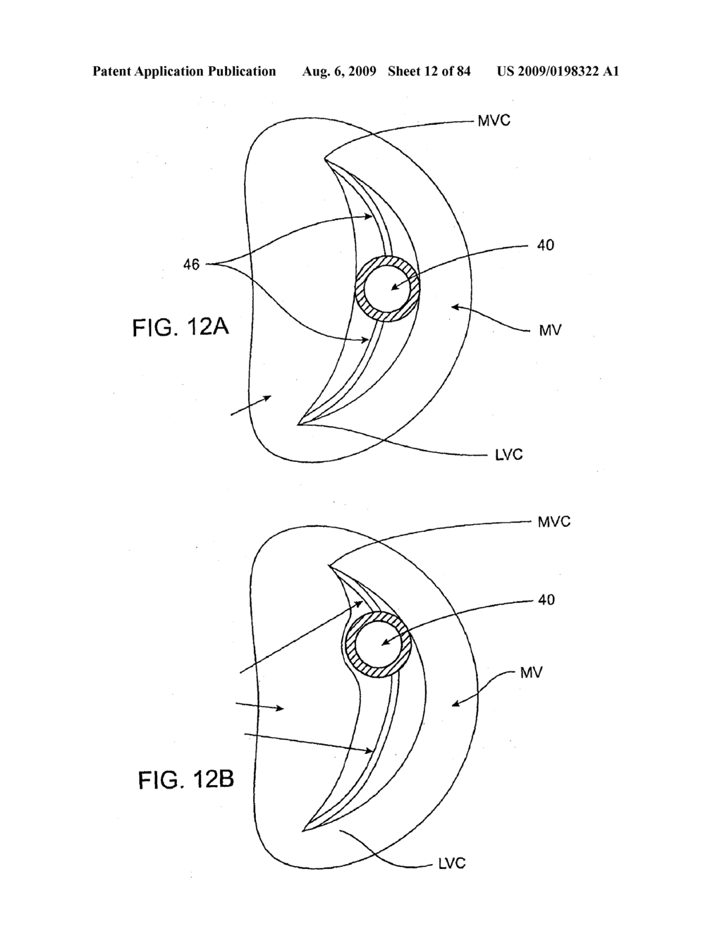 Methods And Apparatus For Cardiac Valve Repair - diagram, schematic, and image 13