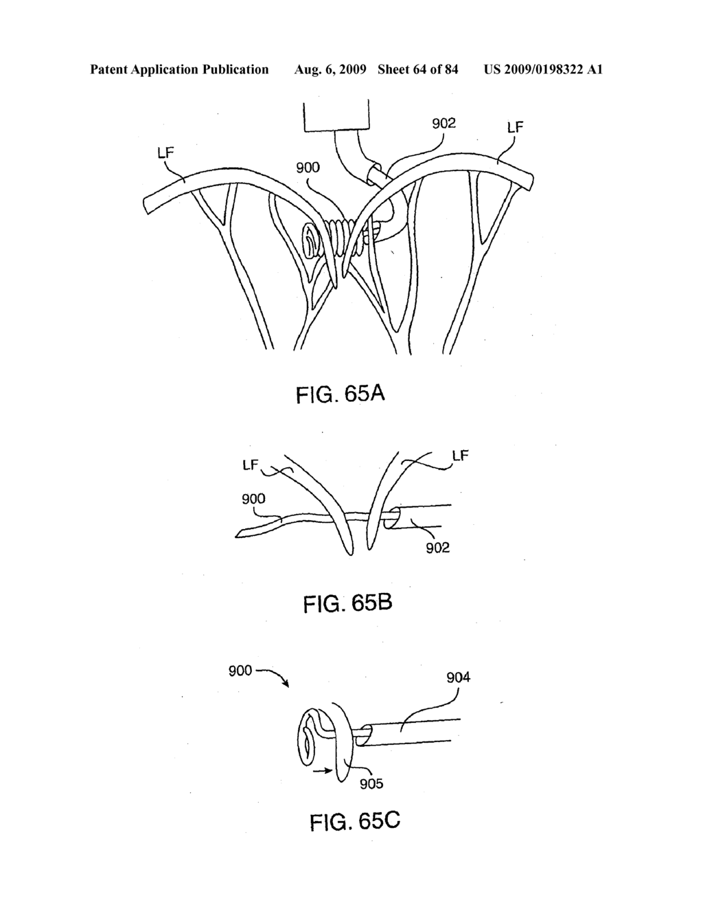 Methods And Apparatus For Cardiac Valve Repair - diagram, schematic, and image 65