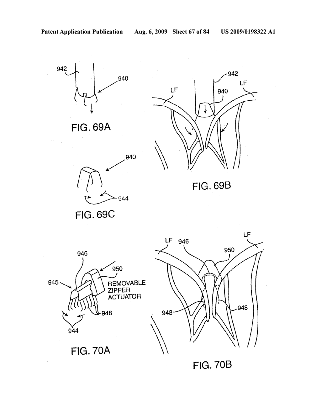 Methods And Apparatus For Cardiac Valve Repair - diagram, schematic, and image 68