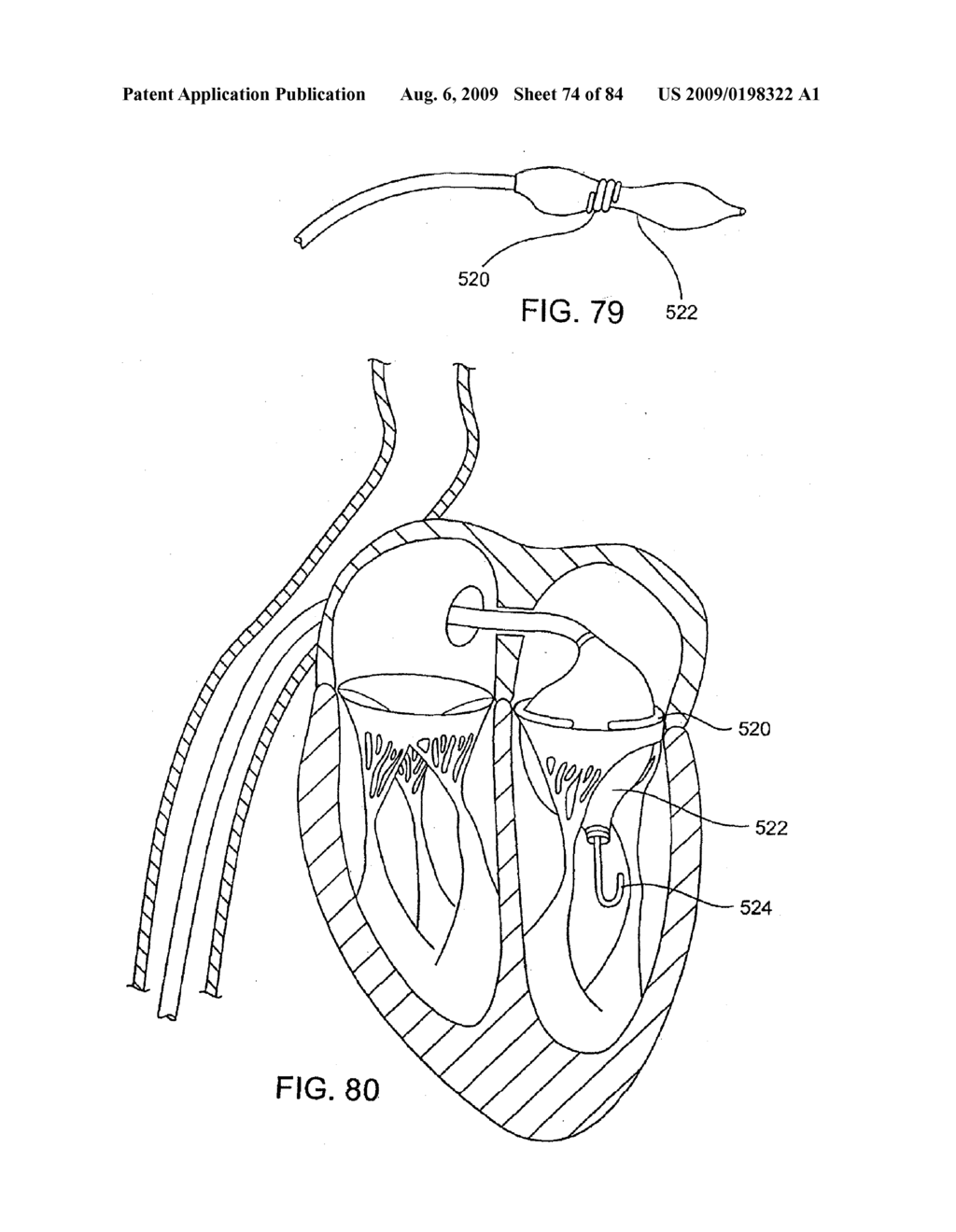 Methods And Apparatus For Cardiac Valve Repair - diagram, schematic, and image 75