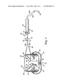 Prosthetic Heart Valve System diagram and image