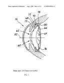 ACCOMMODATIVE INTRAOCULAR LENS SYSTEM diagram and image