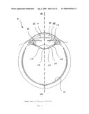 ACCOMMODATIVE INTRAOCULAR LENS SYSTEM diagram and image