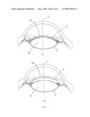 ACCOMMODATIVE INTRAOCULAR LENS SYSTEM diagram and image