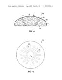 BREAST IMPLANT WITH ADJUSTABLE COMPRESSION RESPONSE diagram and image