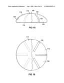 BREAST IMPLANT WITH INTERNAL FLOW DAMPENING diagram and image