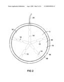 COMPRESSIBLE COSMETIC PROSTHESIS WITH IMPROVED SHAPE RETENTION diagram and image