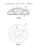 IMPLANTABLE PROSTHESIS WITH OPEN CELL FLOW REGULATION diagram and image