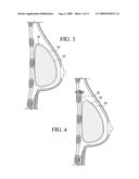 METHOD FOR TEXTURING THE SURFACE OF A SYNTHETIC IMPLANT diagram and image