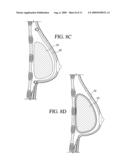 METHOD FOR TEXTURING THE SURFACE OF A SYNTHETIC IMPLANT diagram and image