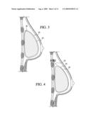 METHOD FOR TEXTURING THE SURFACE OF A SYNTHETIC IMPLANT diagram and image