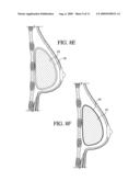 METHOD FOR TEXTURING THE SURFACE OF A SYNTHETIC IMPLANT diagram and image