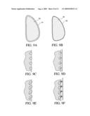 METHOD FOR TEXTURING THE SURFACE OF A SYNTHETIC IMPLANT diagram and image