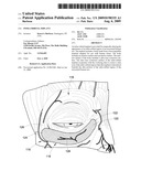 INFRA-ORBITAL IMPLANT diagram and image