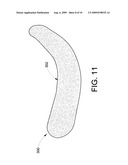 INFRA-ORBITAL IMPLANT diagram and image