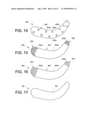 INFRA-ORBITAL IMPLANT diagram and image