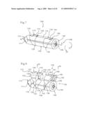 MEDICAL IMPLANTS AND METHODS diagram and image