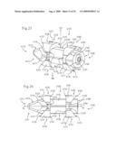 MEDICAL IMPLANTS AND METHODS diagram and image