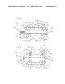 MEDICAL IMPLANTS AND METHODS diagram and image