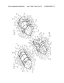 MEDICAL IMPLANTS AND METHODS diagram and image