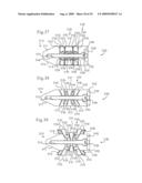 MEDICAL IMPLANTS AND METHODS diagram and image