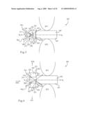 MEDICAL IMPLANTS AND METHODS diagram and image