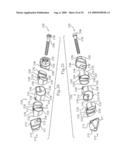 MEDICAL IMPLANTS AND METHODS diagram and image